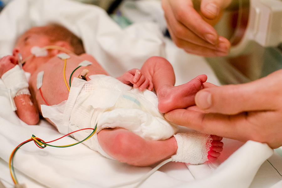 premature-babies-kidshealth-nz